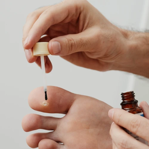 Syylien ehkäisy ja poisto